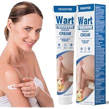 Skin Tag Remover & Wart Remover Cream Fast Acting Natural Skin Tag Removal Treatment with Purslane & Phellodendron Bark, Gentle Skin Tag Remover for Neck, Face, Body, Mole & Wart Remover Care