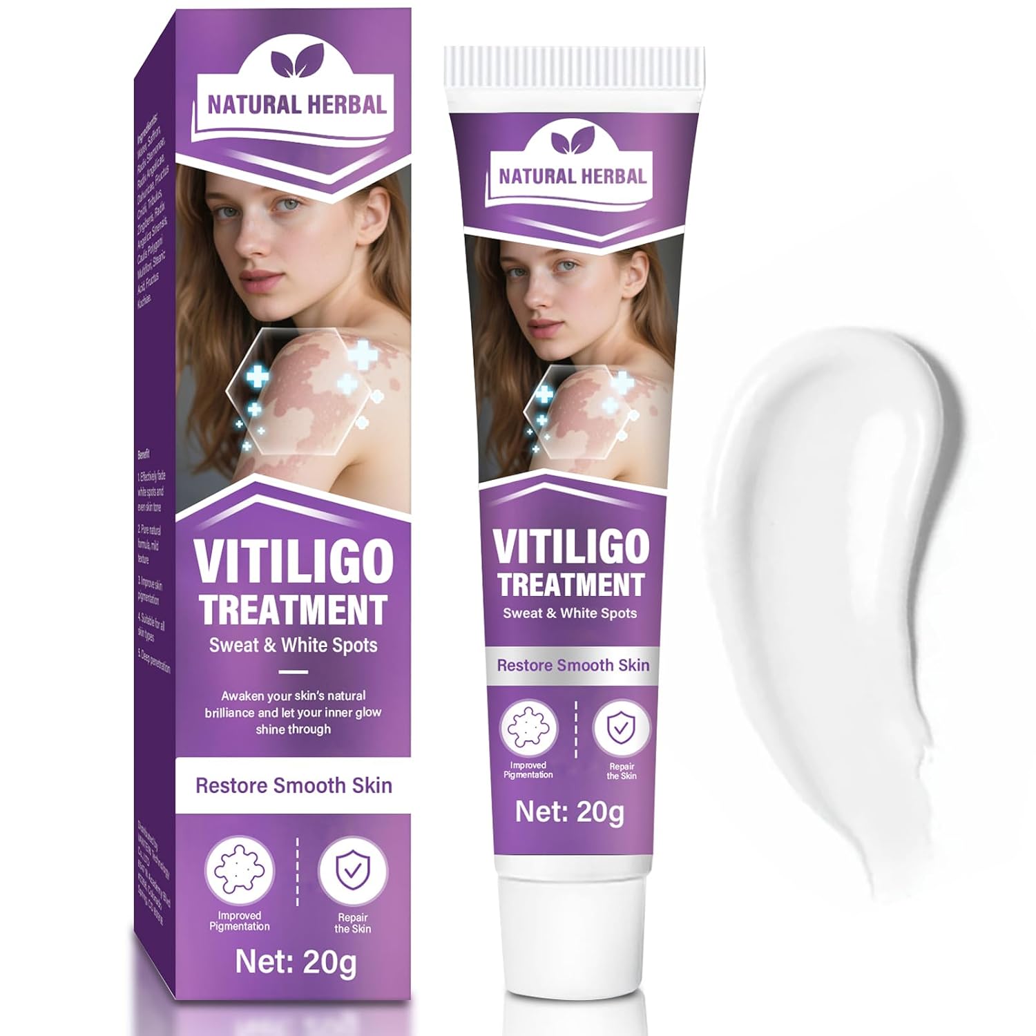 Vitiligo Treatment Cream, Natural Vitiligo Cream Treatment for Skin Vitiligo, Reduces White Spots & Improve Skin Pigmentation, 20g
